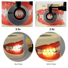 Dental Loupe With Wireless LED Headlight 2.5X / 3.5X Unique - product image 9