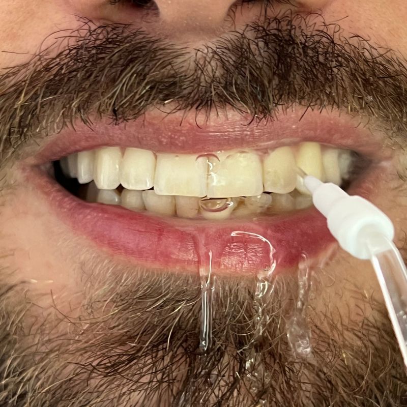 Oral Irrigator Water Flosser Supersonic Deep Clean - product image 3